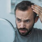 2 Factors That Contribute To A “Failed Hair Transplant”
