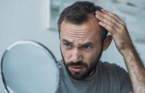 2 Factors That Contribute To A “Failed Hair Transplant”