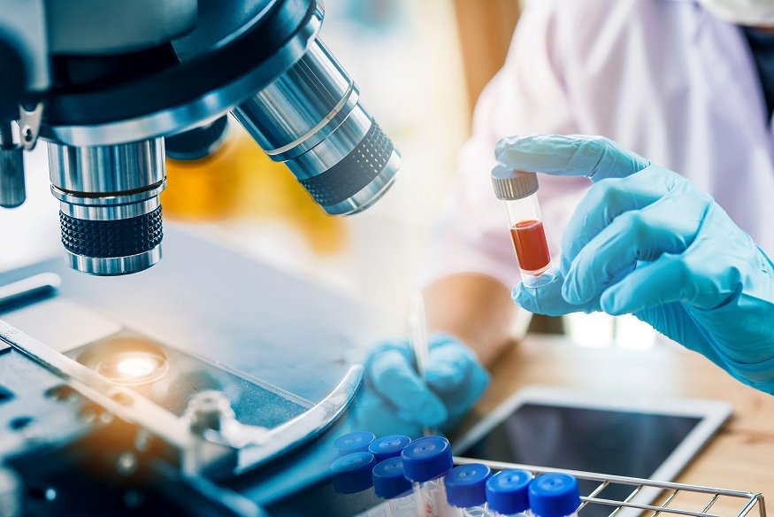 Health Tips Before Your GAMCA Medical Test