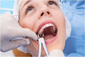 What Should You Do If Your Tooth Hurts After Extraction?